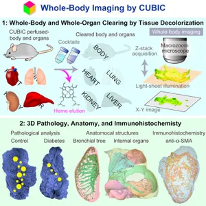 Whole-body imaging with single-cell resolution by tissue-decolorization