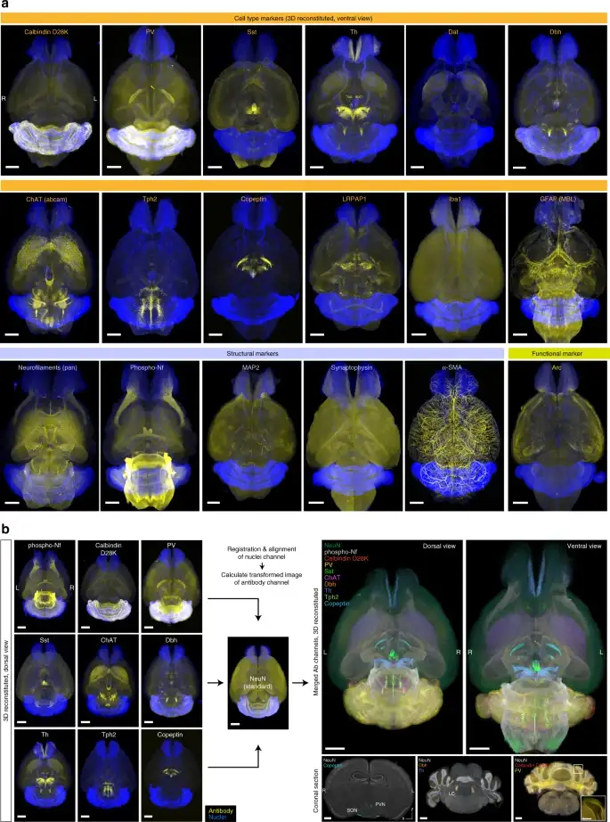 Versatile whole-organ/body staining and imaging based on electrolyte-gel properties of biological tissues