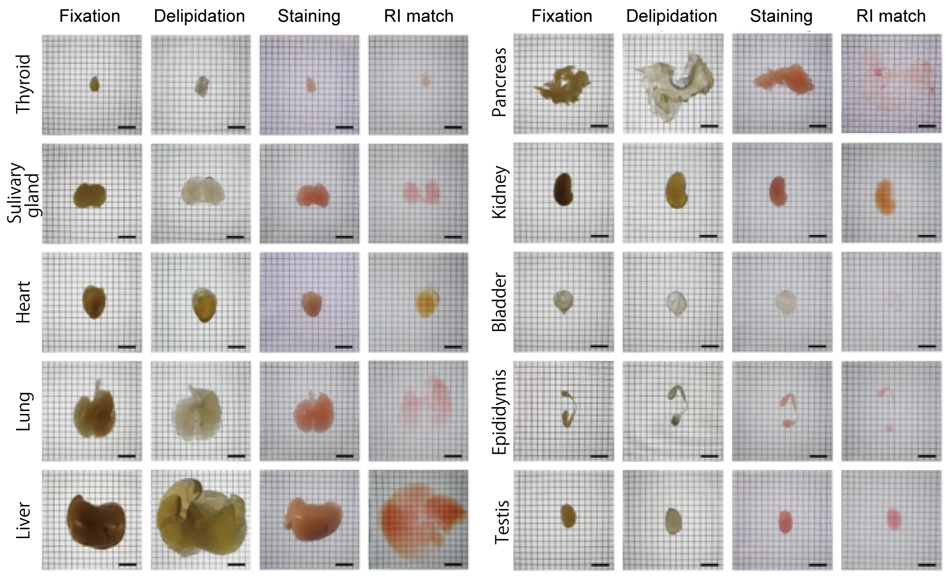 Tissue clearing example