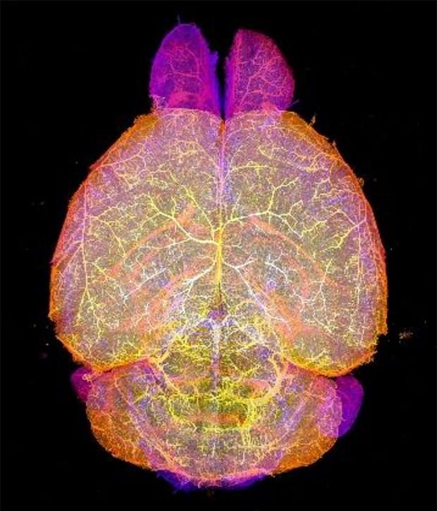 Pharmacokinetic analysis
