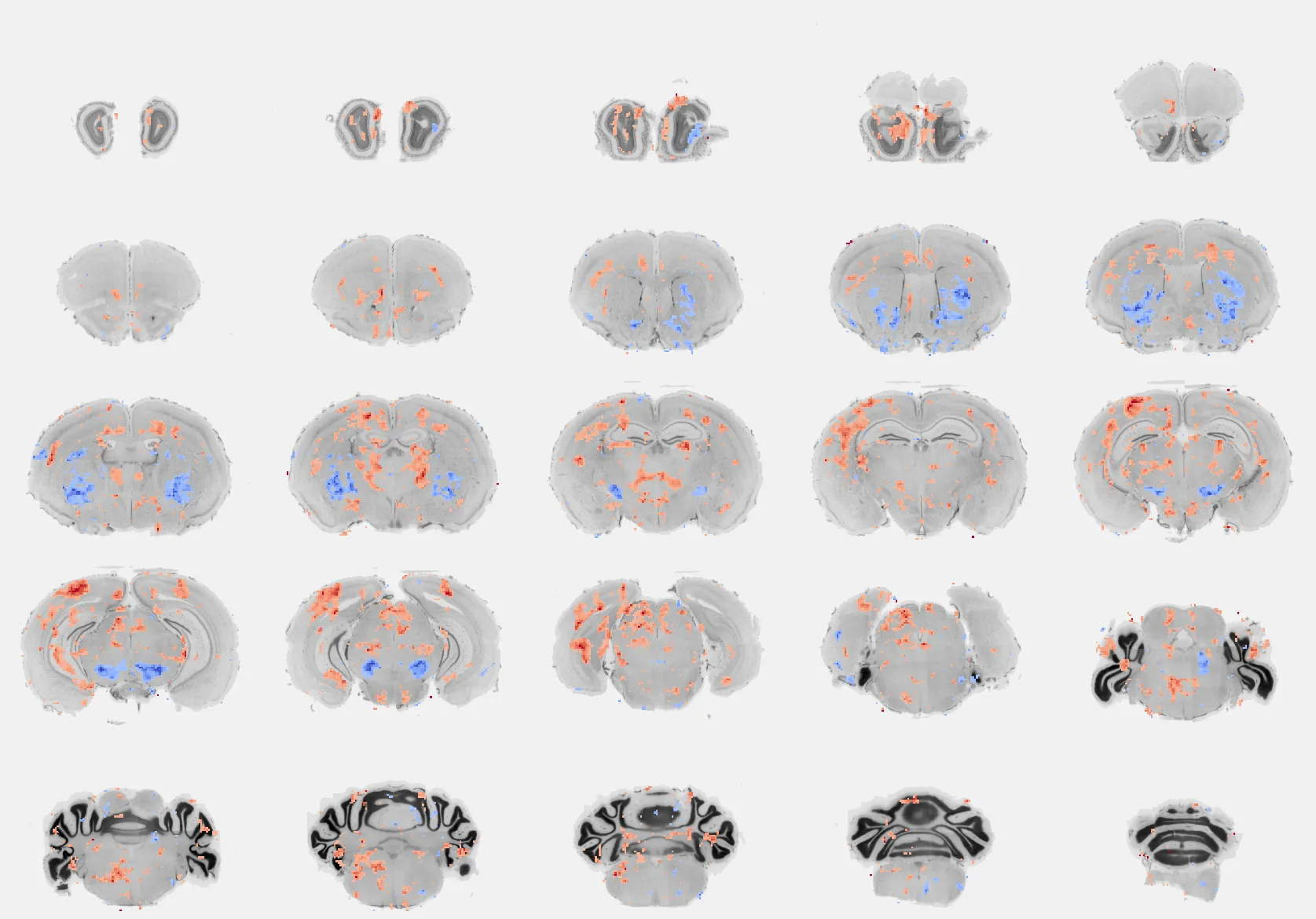 Tissue clearing example