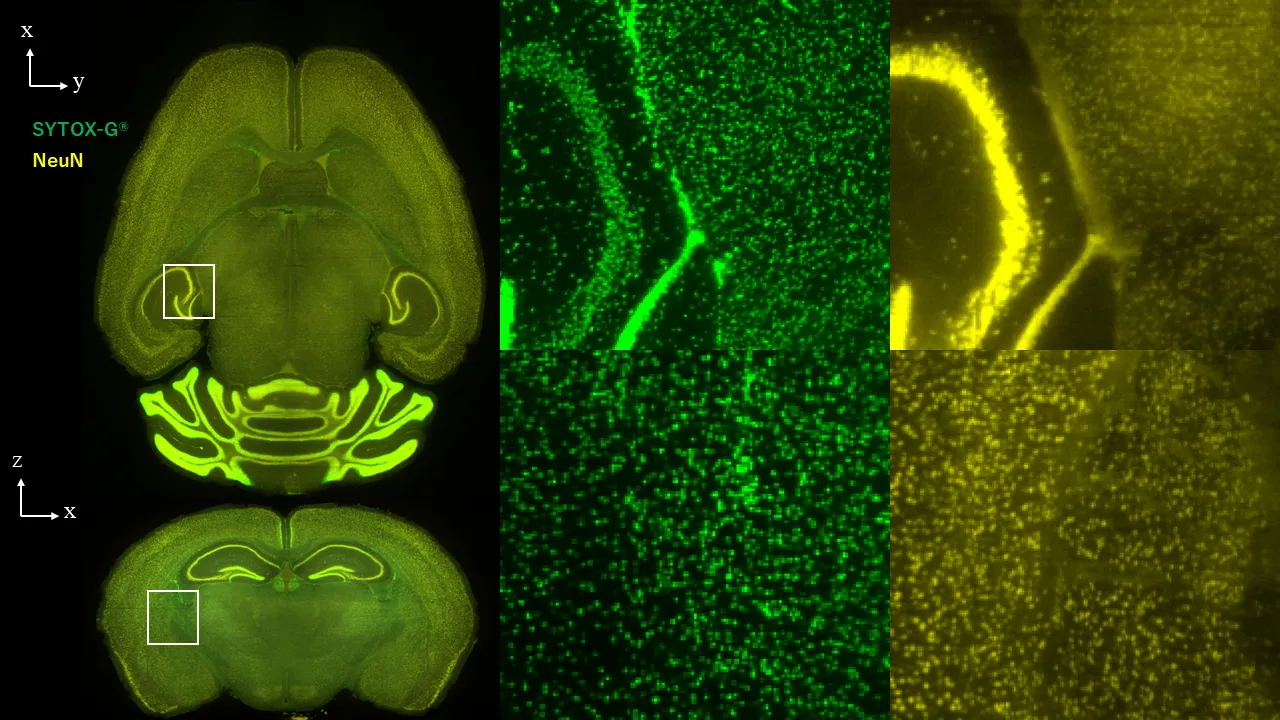 Tissue clearing example